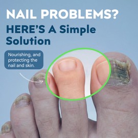 Nail Care Pen - Professional Nail Care for Improving the Look of Discolored or Damaged Nails, 3ML