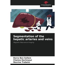 Segmentation of the hepatic arteries and veins: Magnetic Resonance Imaging
