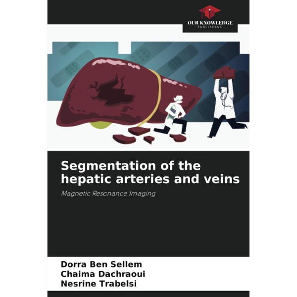 Segmentation of the hepatic arteries and veins: Magnetic Resonance Imaging