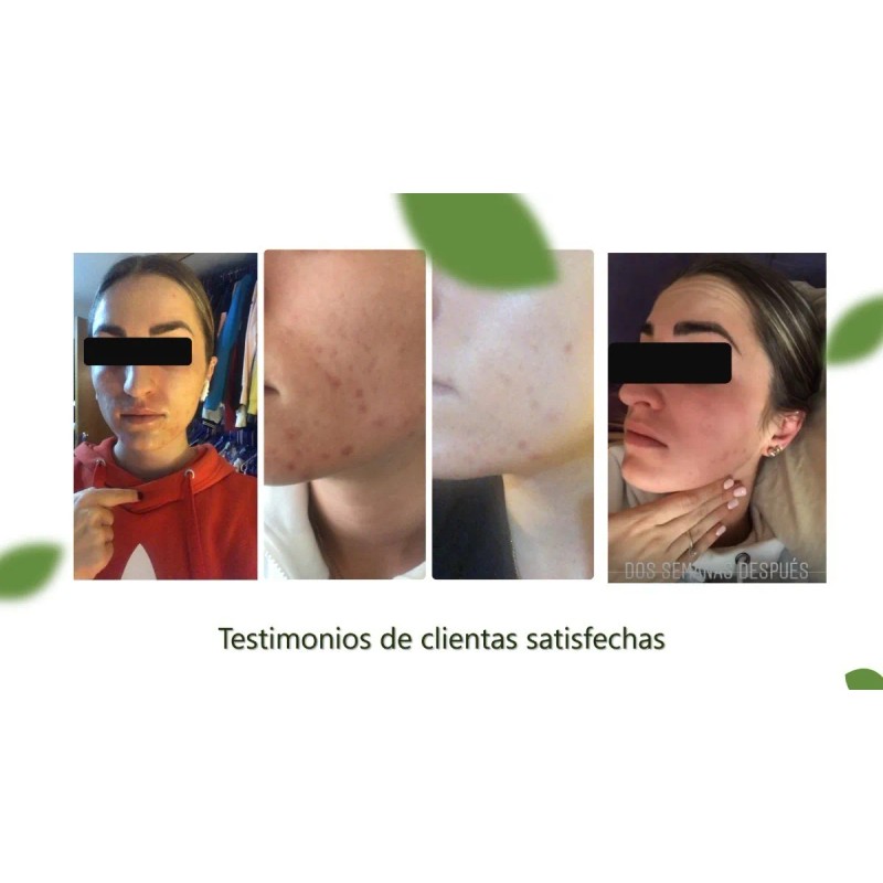 Zannabis Crema Facial Hidratante