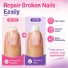 Broken Nail Repair Kit for Cracked, Split and Torn Fingernails