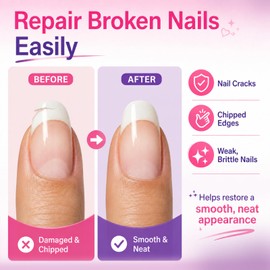 Broken Nail Repair Kit for Cracked, Split and Torn Fingernails