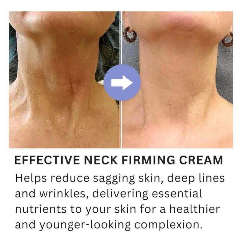 2 Cremas Reafirmantes Para Cuello Tighting & Lift, Cremarea1