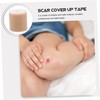 NOLITOY 2 Rolls Scar Stickers Scar Patches Supplies Elastic Bandage