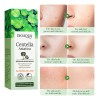 Serum Bioaqua Centella Asiatica Antiacn Control Grasa Todo Tipo De