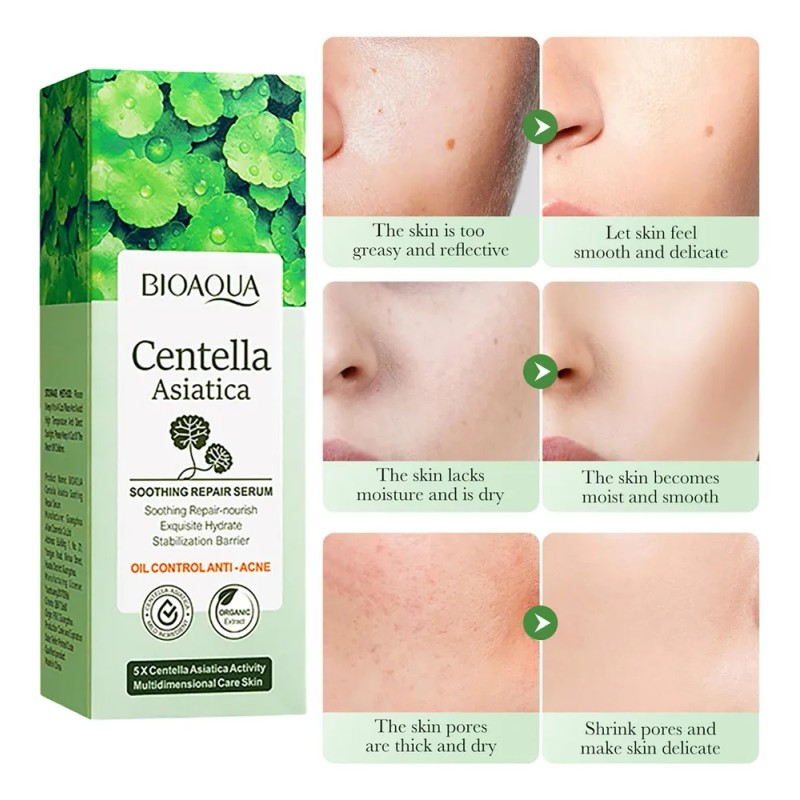 Serum Bioaqua Centella Asiatica Antiacn Control Grasa Todo Tipo De