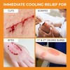 Medagel The Original Moist Burn Pad - Hydrogel Healing Pads,