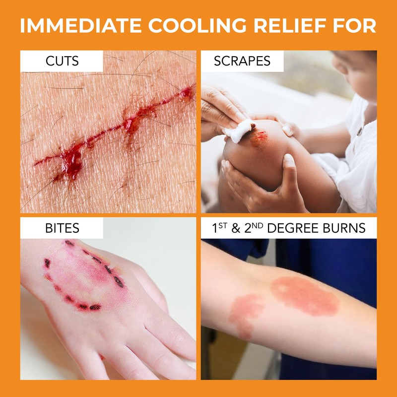 Medagel The Original Moist Burn Pad - Hydrogel Healing Pads,