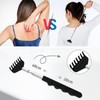 Scalp Massagers Back Scratcher, 20 Fingers Scalp Scratcher Head Massager