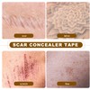 FOMIYES Waterproof Scar Concealer Tape, Invisible Skin Tone Cover up