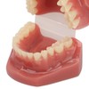 Tooth Model 28 Teeth Dental Orthodontic Model Teaching Study Supplies