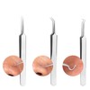 Acne & Blemish Remover Sebum Extractor Tool Hook Tweezers 13ea