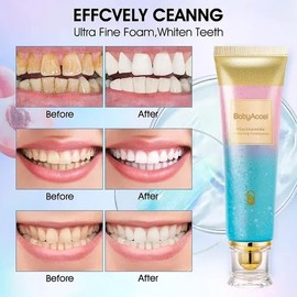 2pcs Dentífrico Blanqueador Dentífrico Blanqueador Suave