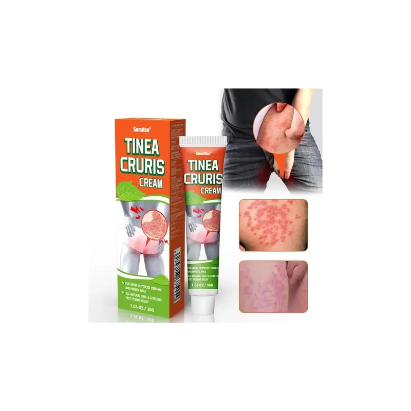 Pomada H Tinea Cruris 30g Crema Para Picazón En La