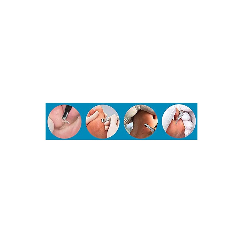 Pack of 10 No. 2 Gouge Blades Foot Care Blades