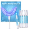 Shynova Teeth Bleaching Set for White Teeth: Teeth Whitening Kit