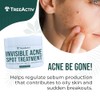 TreeActiv- Tratamiento invisible para el acné quístico con ácido salicílico