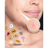Nipskin Pimple Patches Edición Daniela Salcedo