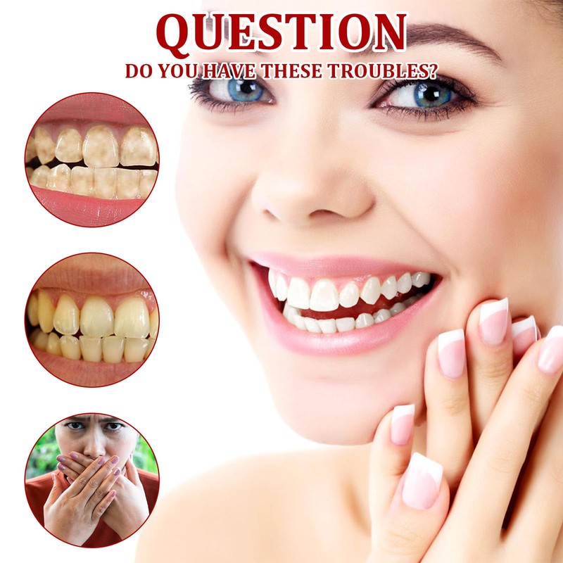 2PCS Sp8 Probiotic Toothpaste,Fresh P-8 Probiotics Toothpaste, Sp-8 Ultra Whitening