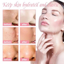 Dyceittdia 75 ml Niacinamide Serum and 50 ml Watermelon Essence Face Cream, Watermelon Essence Set, Moisturising Skin, Cream4