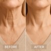 Invisible Neck Lift Tape Neck Instant Lifting Firming Tape Improves