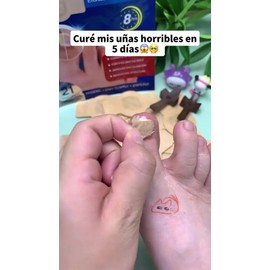 30pz Parches Antimicóticos For El Tratamiento De Uñas                                                                                                 