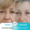 Instantly Ageless Jeunesse - Bolsa 5 Viales Remueve Arrugas