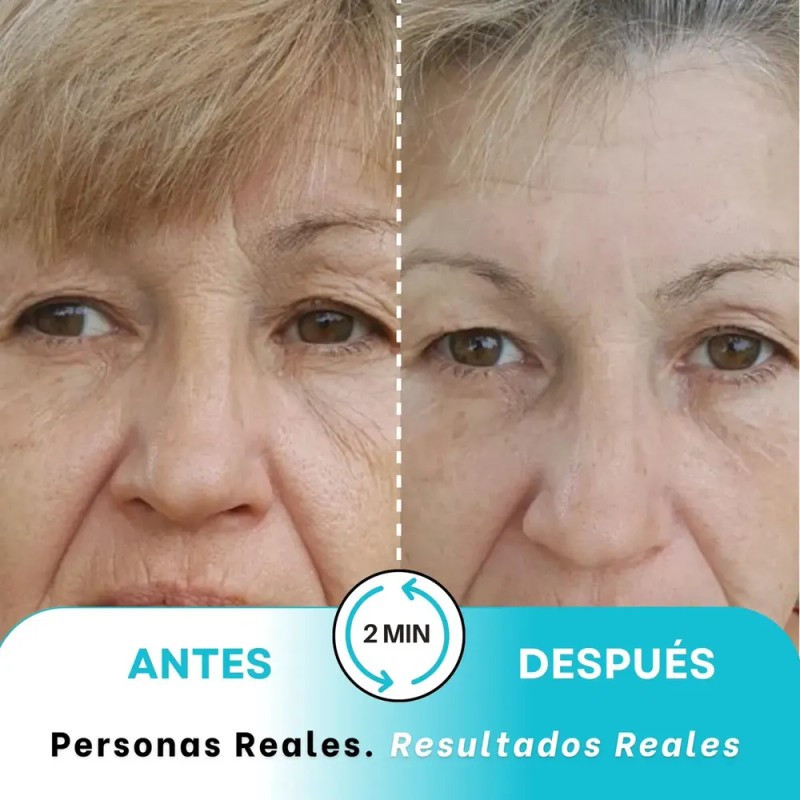 Instantly Ageless Jeunesse - Bolsa 5 Viales Remueve Arrugas