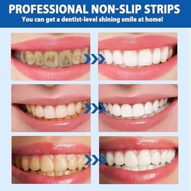 28PCS Tiras Blanqueadoras Dentales 9D, Teeth Whitening strips Anti-Deslizantes, Sabor Menta Refresca Respiración, Blanquear los Dientes de Forma Rápid