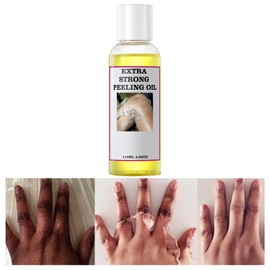 Peeling Oil for Dark Skin, Peeling Solution with Salicylic Acid, Exfoliating for Body, Dull Skin & Uneven Skin Tone, Peeling Solutions For Glowing Skin, 110ML/3.66 OZ