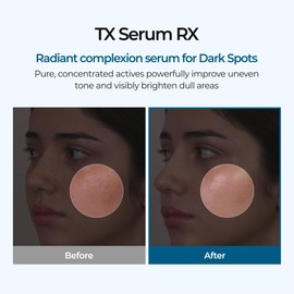 Dr.Melaxin TX Ampoule RX – Tranexamic Acid Facial Ampoule with Niacinamide for Dark Spots, Hyperpigmentation & Melasma Care, Korean Skincare, 1.01 Fl.Oz (30ml)