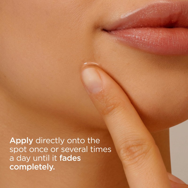 ISDIN Acniben On The Spot, Facial Pimples Corrector Drying Gel,