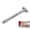 Hip Dysplasia Changing Diapers with Velcro for Spica Body Cast