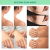4 Pcs Elaimei Silicone Scar Sheets Stretch Marks Remover Post