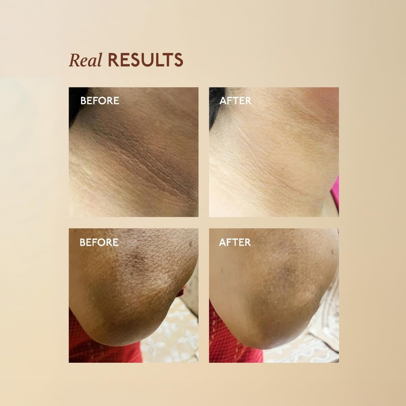 ASAYA Asaya Tone Restore Advanced Pigmentation Cream with MelaMe™ Complex
