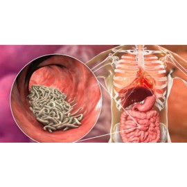 PETMED4LESS.COM Natural Dewormer for Man & Women formulated to kill, flush worms parasites  eggs