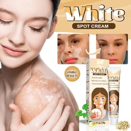 2er-Pack White Spot Cream, Vitiligo Skin Care Balm, Skin Therapy Cream, Feuchtigkeitsspendend, Regeneriert die Hautpigmentierung, für Männer und Frauen Geeignet