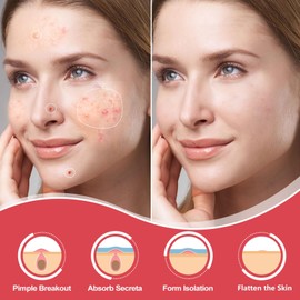 Pimple Patches for Face, Hydrocolloid Acne Patches Zit Patches for Face Acne Spot Patch Cystic Acne 432 Counts