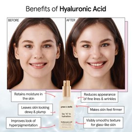 grace & stella Suero de ácido hialurónico galardonado (50ml/1.7 fl oz) Suero hidratante de ácido hialurónico para la cara - Ácido hialurónico para muj