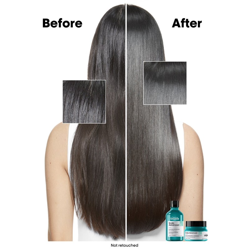 LOreal Professionnel L'Oréal Professionnel Serié Expert Scalp Advanced Anti-Oiliness Dermo-Purifier