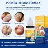 Sefudun Natural Plant Drops for Nails Care Tea Tree and