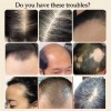 Unbranded Yao Pin Anti-Hair Loss & Hair Growth Solution Loss