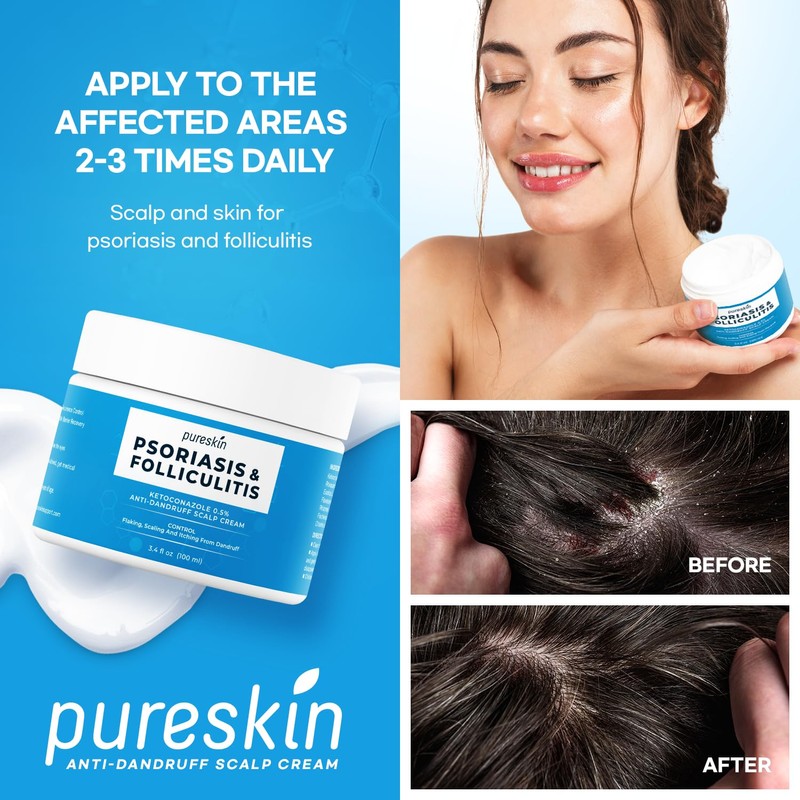Scalp Cream for Psoriasis Folliculitis, Helps Relieve Itching Flaking, with