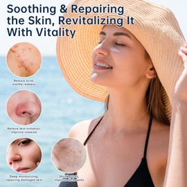 Azelaic Acid 14 Percent Cream For Face, Azelaic Acid Gel, 30ML Azelaic Acid Acne Cream With Salicylic Acid, Niacinamide & Vitamin C For Dark Spot.