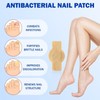 Pack of 42 Nail Patches for Toenails and Fingernails, Multi-Purpose