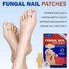 Fungal Nail Patches – 21 Pcs Multi-Purpose Toenail Repair Pads