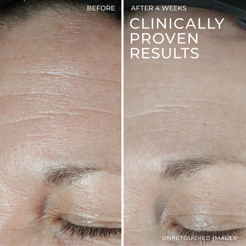 Crema Facial Hidratante Roc Hydration+ Con Ácido I