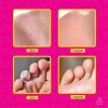 Exfoliante Pies Callos Resequedad Suavidad Repara