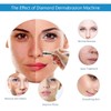 3 in 1 Diamond Microdermabrasion Machine, Facial Skin Care Salon