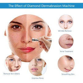 3 in 1 Diamond Microdermabrasion Machine, Facial Skin Care Salon Equipment w/Vacuum & Spray (Strong Suction Power: 65-68cmhg)